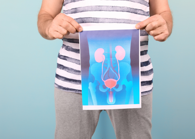 Living Your Best Life with Prostate Cancer
